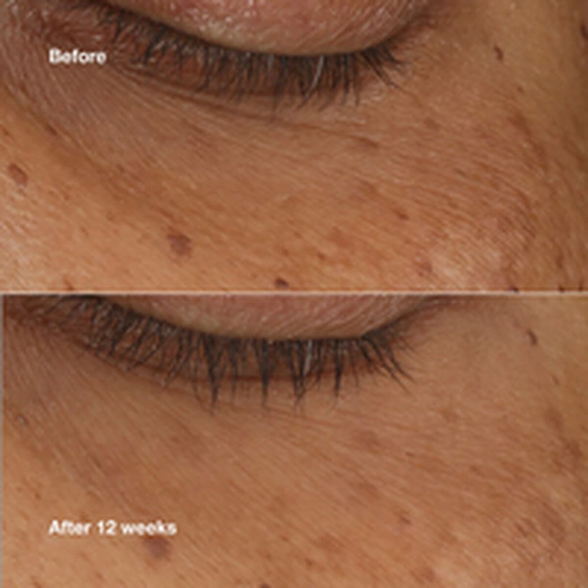 Sérum Iluminador Clinique ALL ABOUT EYES 10 ml - Image 3