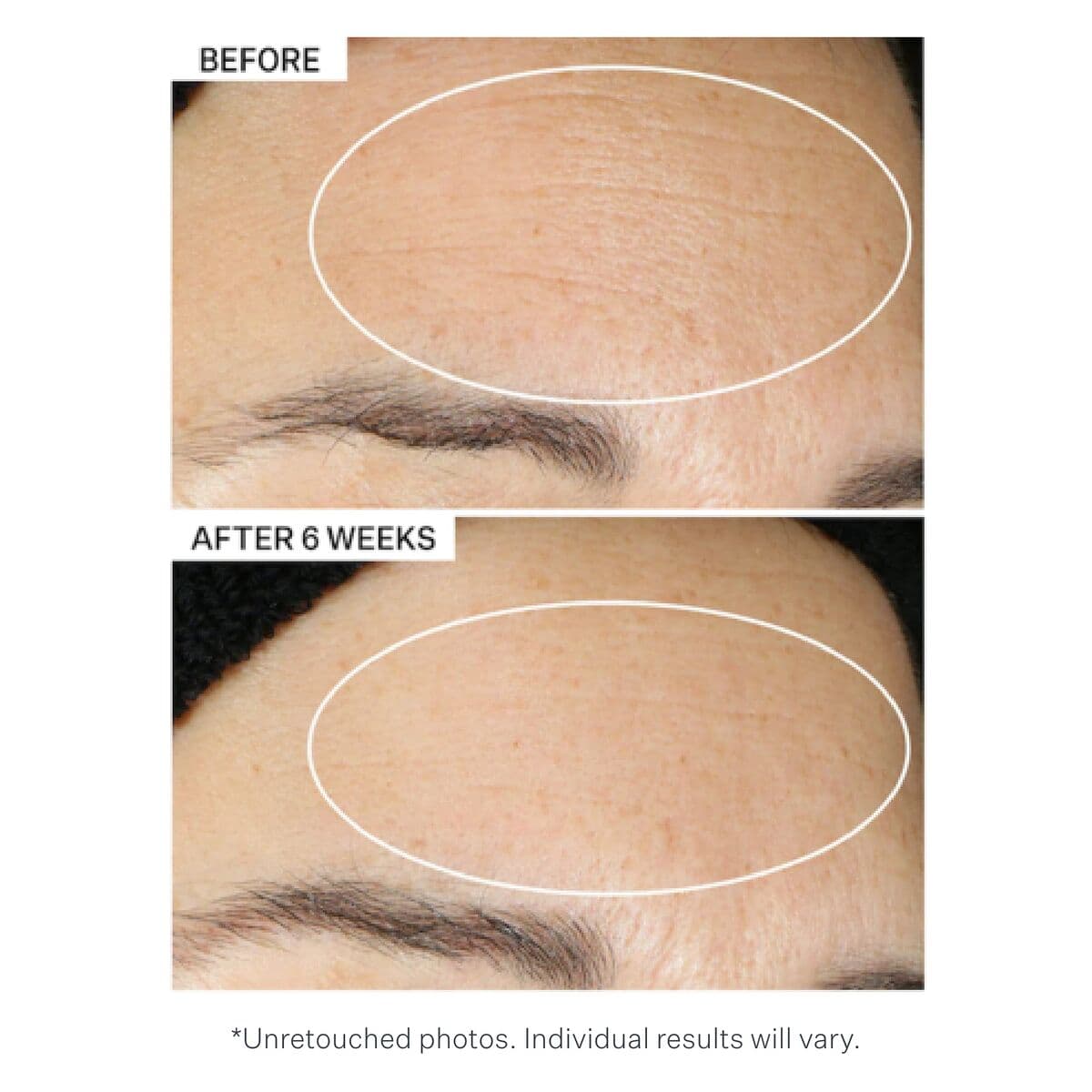 Aceite Facial StriVectin MULTI-ACTION 30 ml Tratamiento Fortificante - Image 6