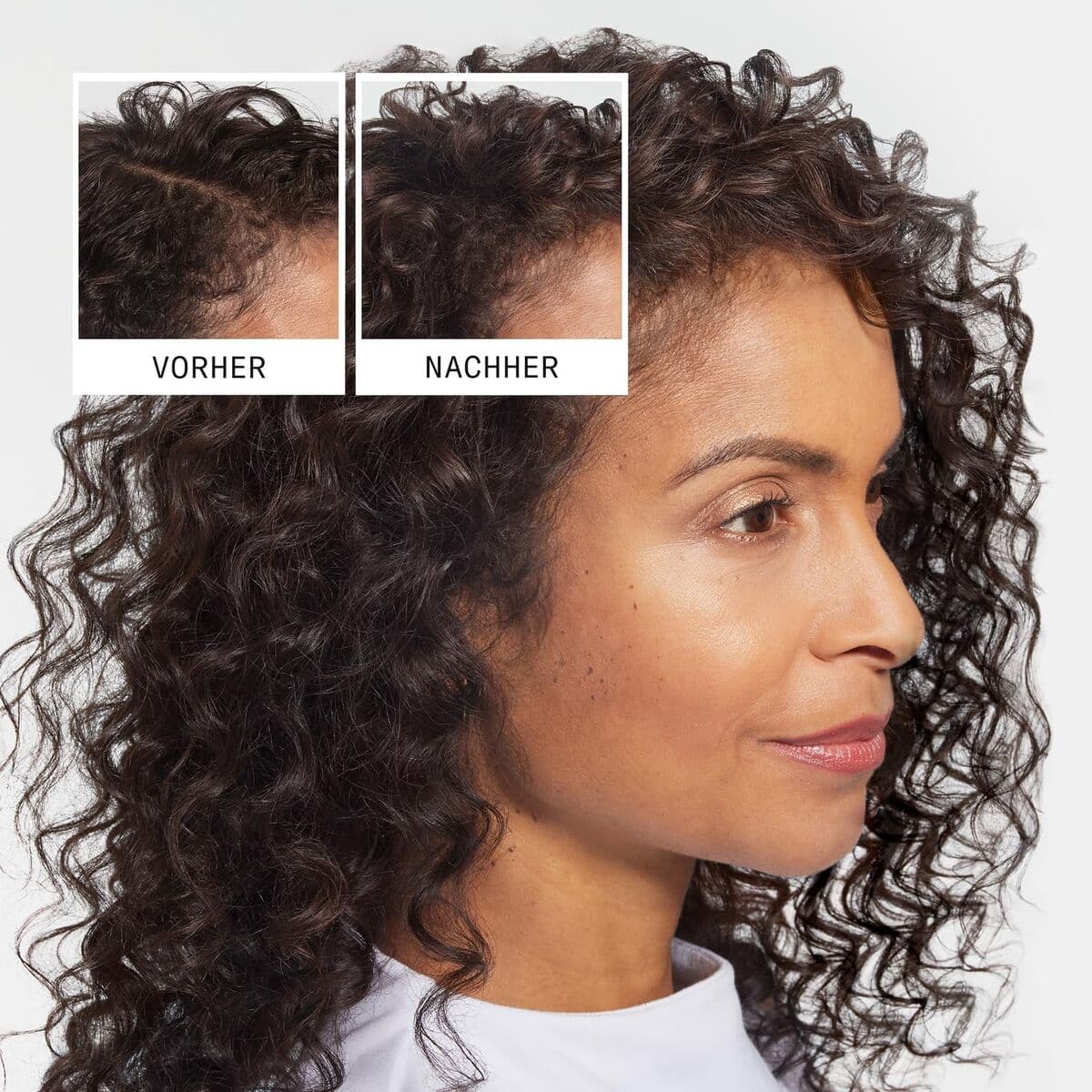 Shampoo Anticaduta Nioxin Anti-Hairloss 475 ml - Image 4